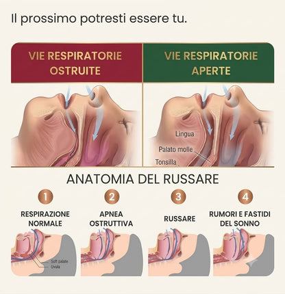 Sleepfit - Dispositivo antirussamento