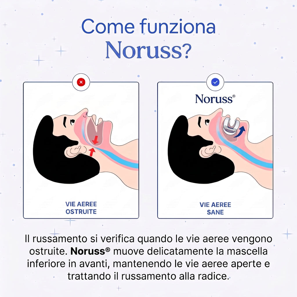 Sostituire sleepfit con Noruss